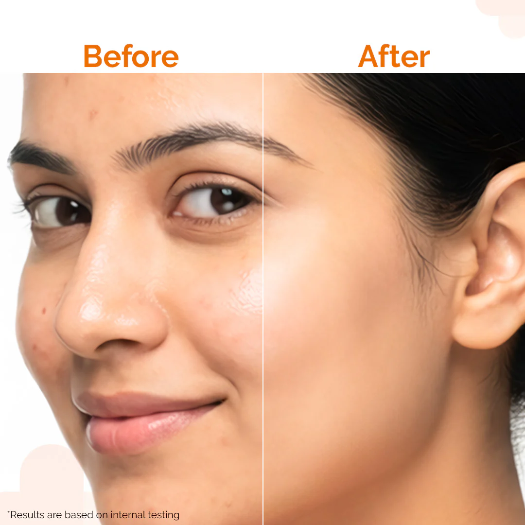 Pore Minimizing Sunscreen Gel with SPF 50 & PA+++ For Open Pores & UVA/UVB Protection - 50 g - Image 4