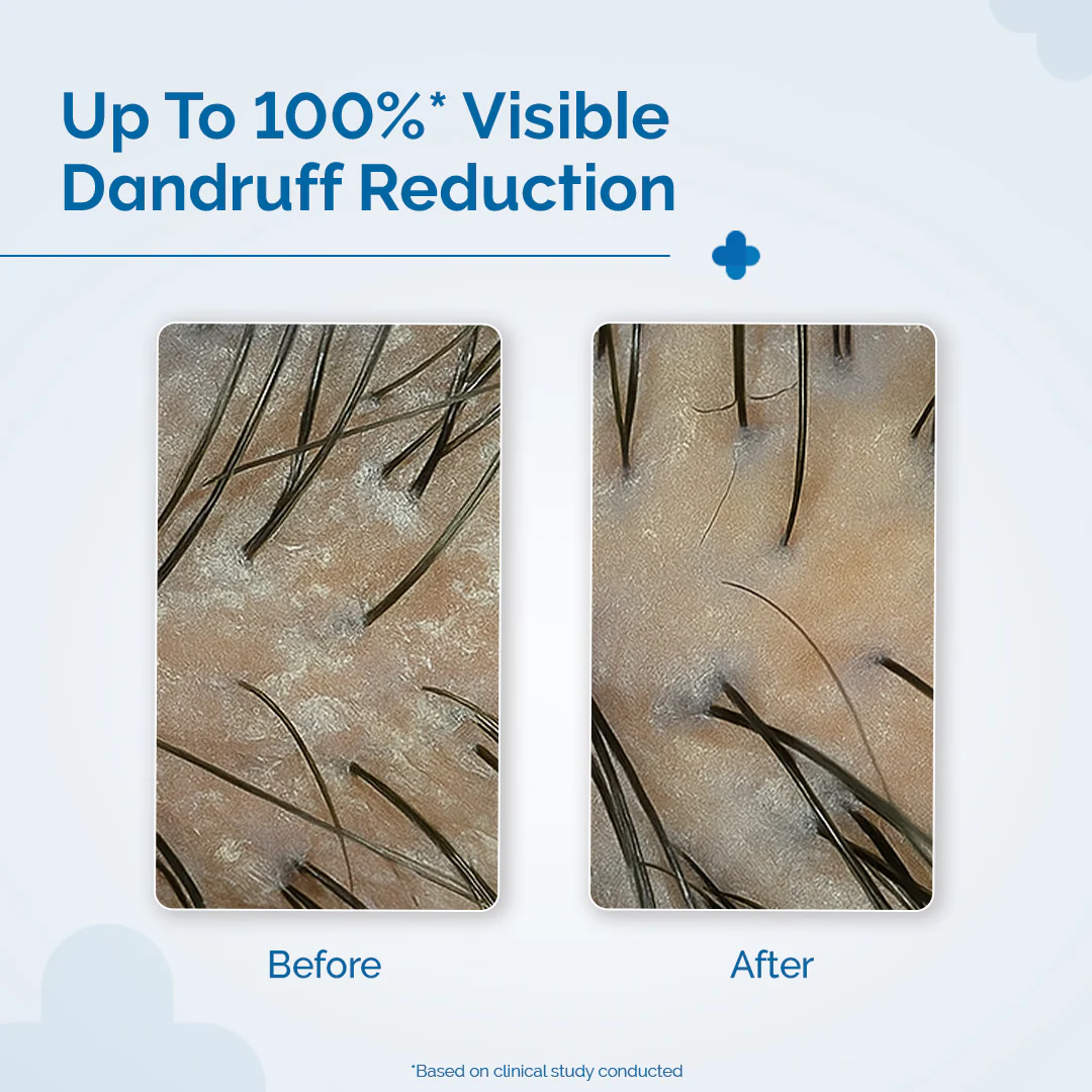 Triple Actives Anti-Dandruff Shampoo - 200 ml - Image 11