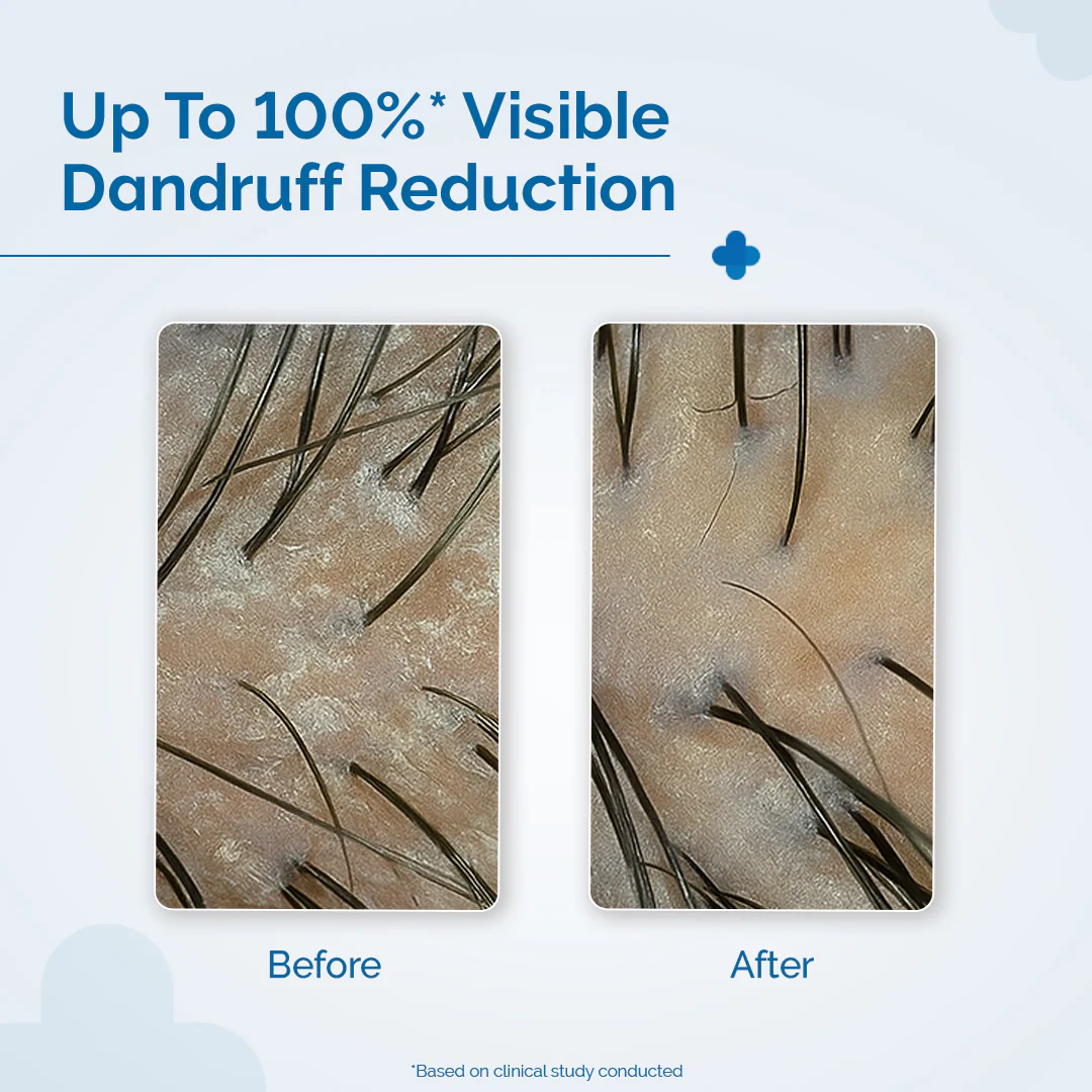 Triple Actives Anti-Dandruff Shampoo - 400ml - Image 4